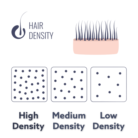 Men's hair density