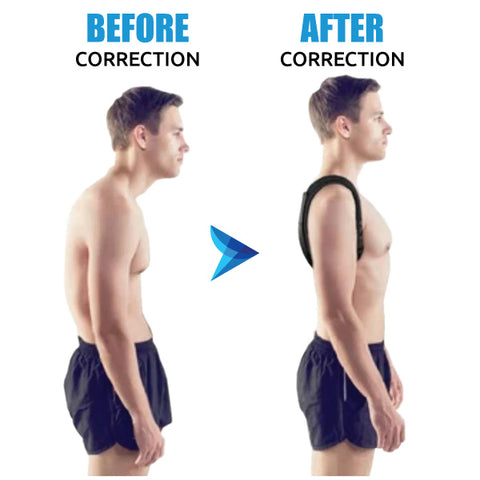 upper posture corrector before and after results