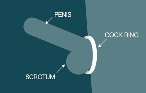 Purpose Of Cock Rings