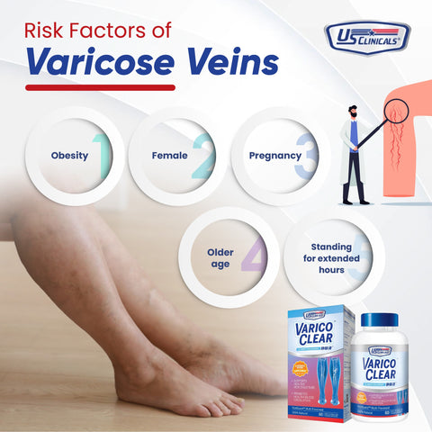 Risk Factors of Varicose Veins