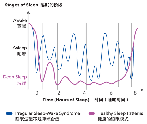 Comparison of sleep patterns-02.png__PID:473b1985-03d5-4258-a72c-58ae3f5649c3