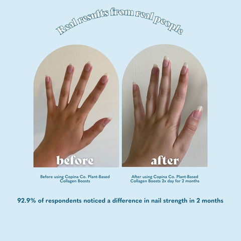 Copina Co. Testimonial Before and After Nails