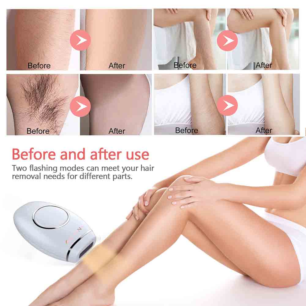 IPL HAIR LASER REMOVAL