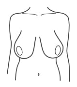 All You Need To Know About Your Breast Shape – Brastop UK