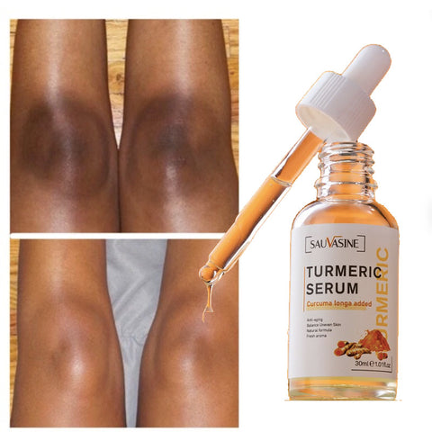 Sérum Turmeric 100% Natural Clareador de Manchas de Pele