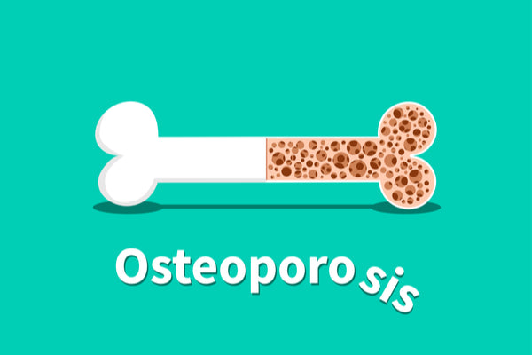 Osteoporosis