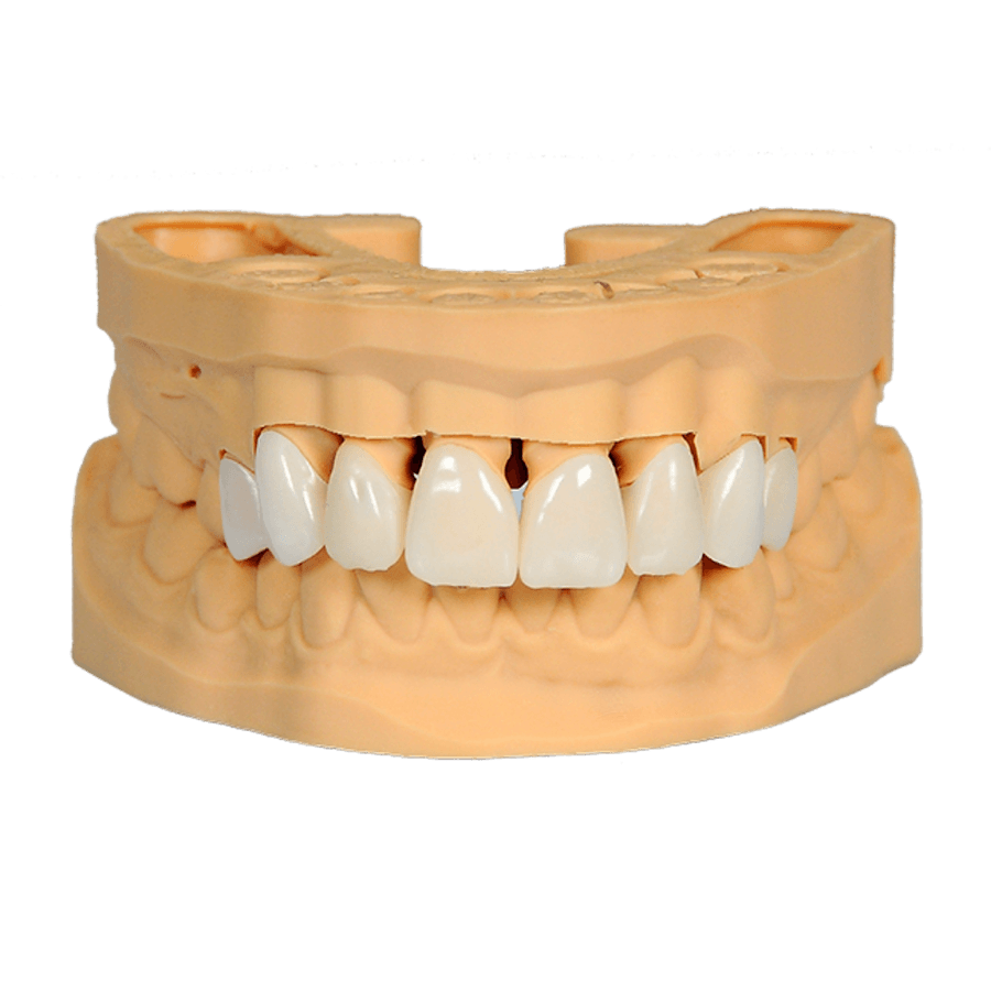 CRS Composite Reçinesi