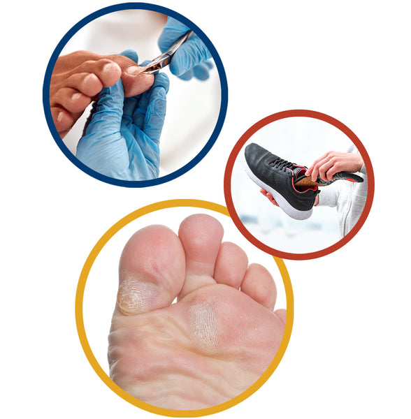 Merivale Podiatry Common Conditions Pic