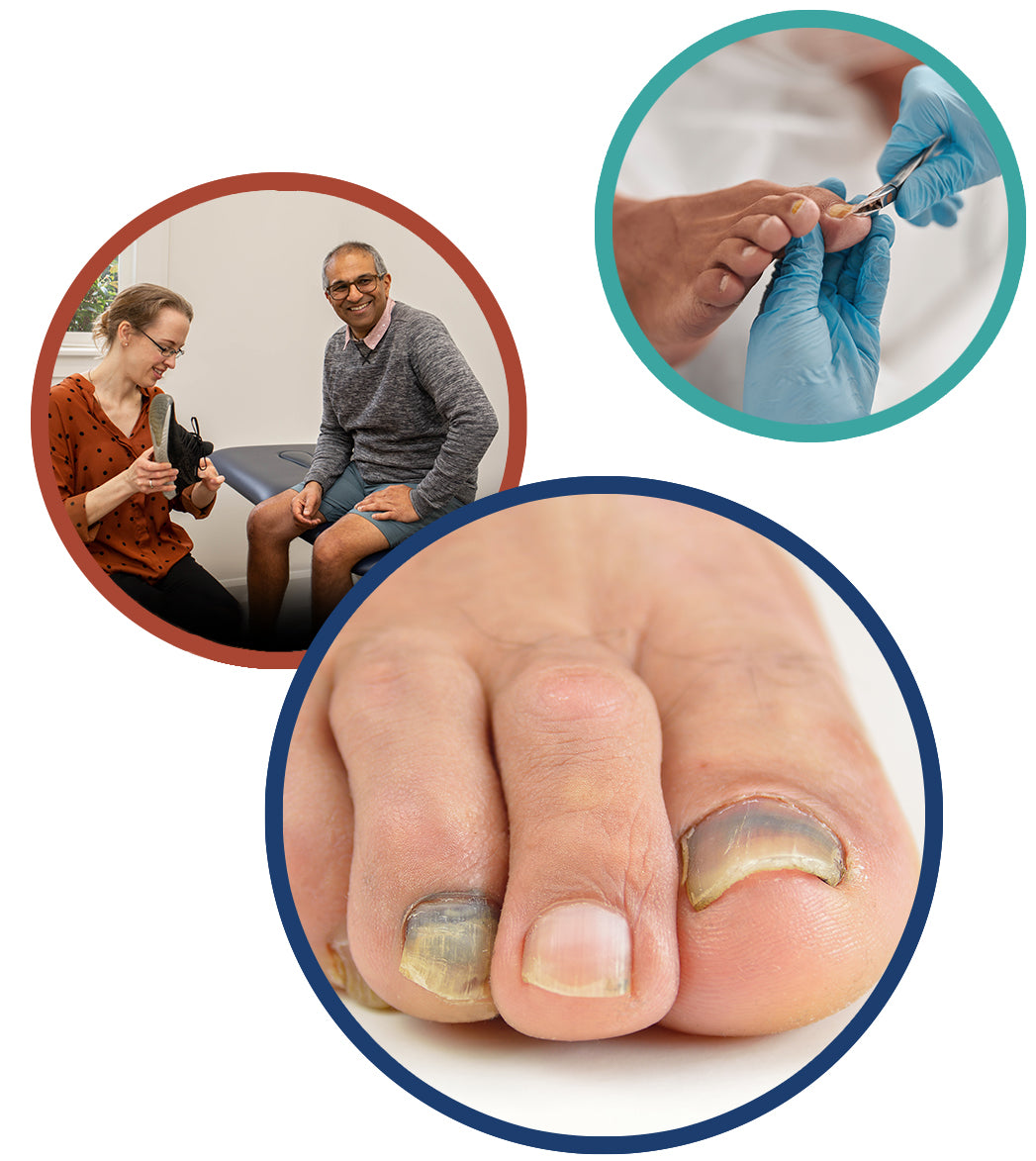 Why Is My Toenail Growing Thick & Discoloured? – merivale-podiatry