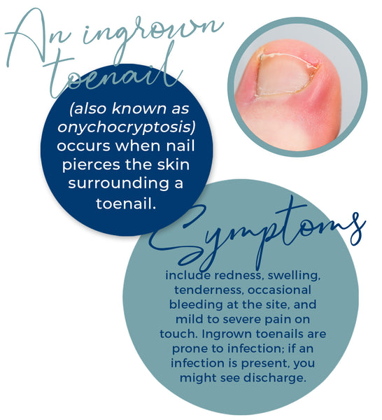 The Ingrown Toenail Clinic