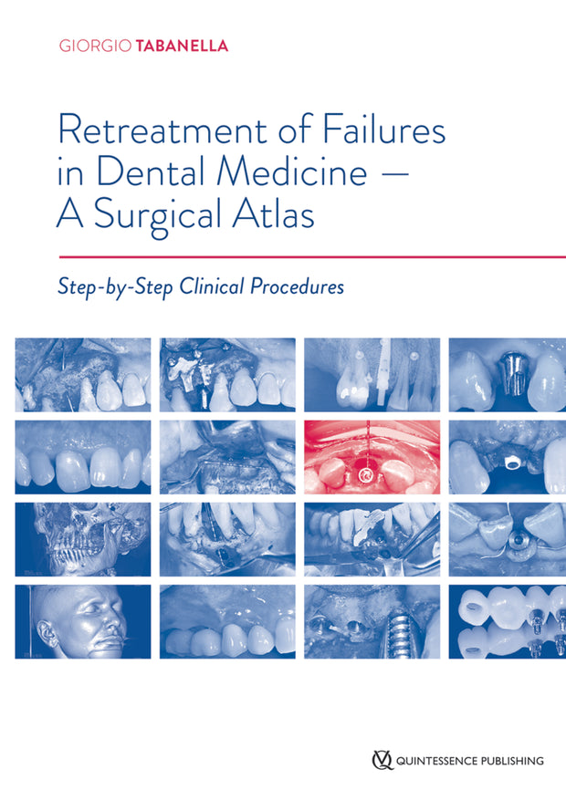 Mahmoud Torabinejad / Richard Rubinstein (Editor) | The Art and Science of  Contemporary Surgical Endodontics