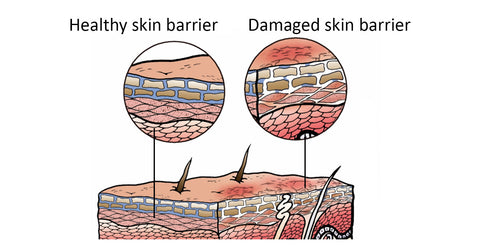 Skin Barrier Repair