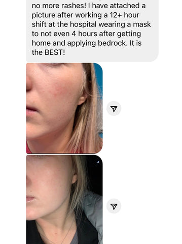anti redness cream before and after bedrock balm
