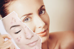 Benefits of AHA in Skincare