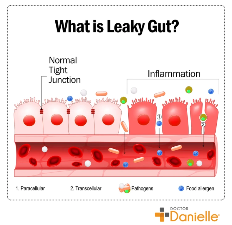 Leaky gut and glutamine 