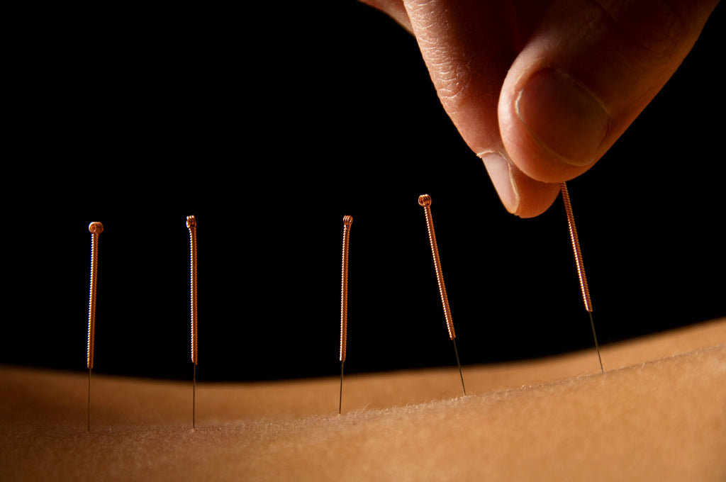 acupuncture for sleep apnea