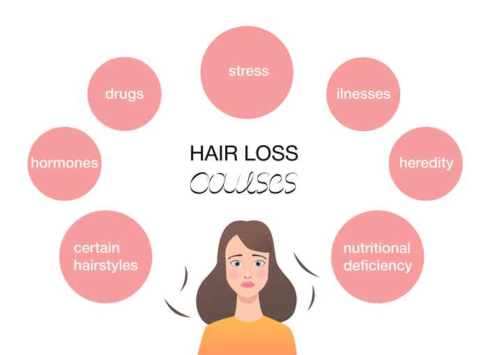 Hair loss (Infographic)