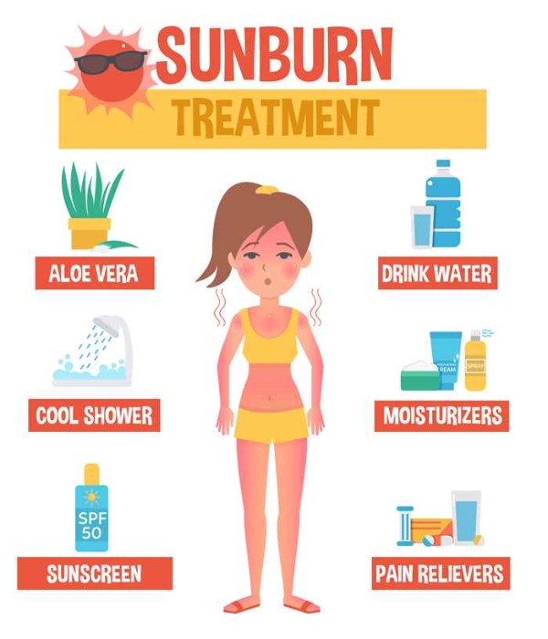 Tips to Cure Sunburn (Infographic)