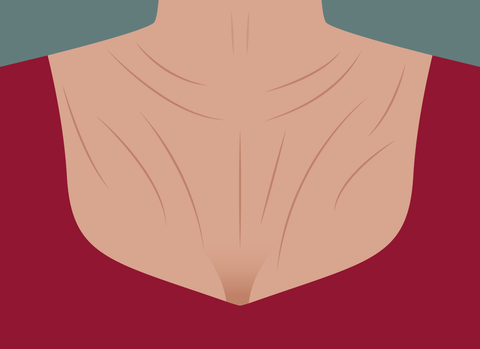 Vector Illustration. Woman Neck and Chest wrinkles.