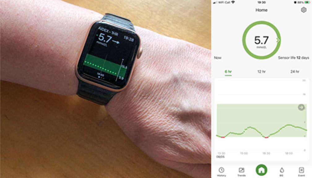 GlucoRx Aidex glucose levels on Apple Watch.