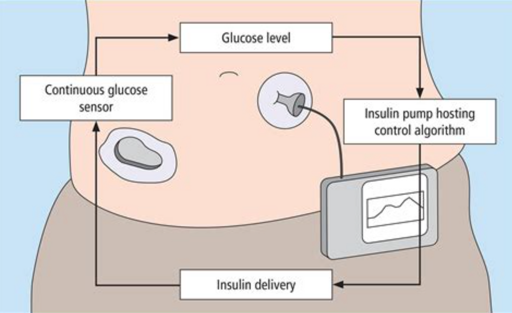 Closed-loop glucose monitoring device