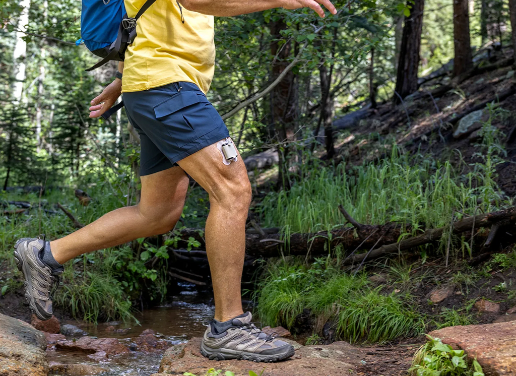 Tandem Diabetes Care insulin pump on runner's upper thigh.