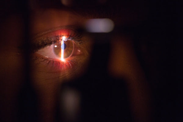 Eye examination for diabetes. Vertical light being shone into patients eye.