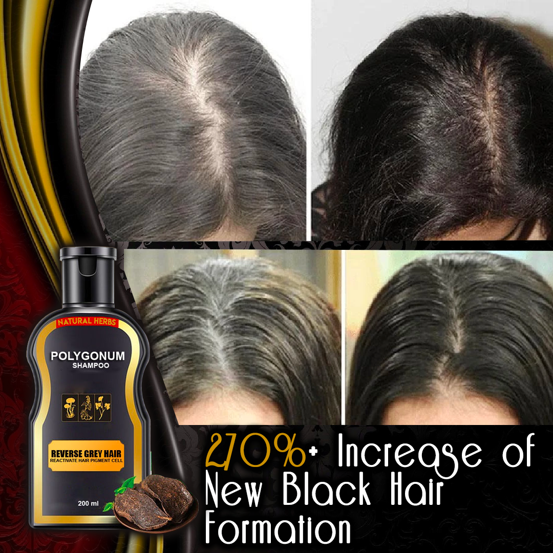 Nice Can Shampoo Reverse Hair Loss for Rounded Face