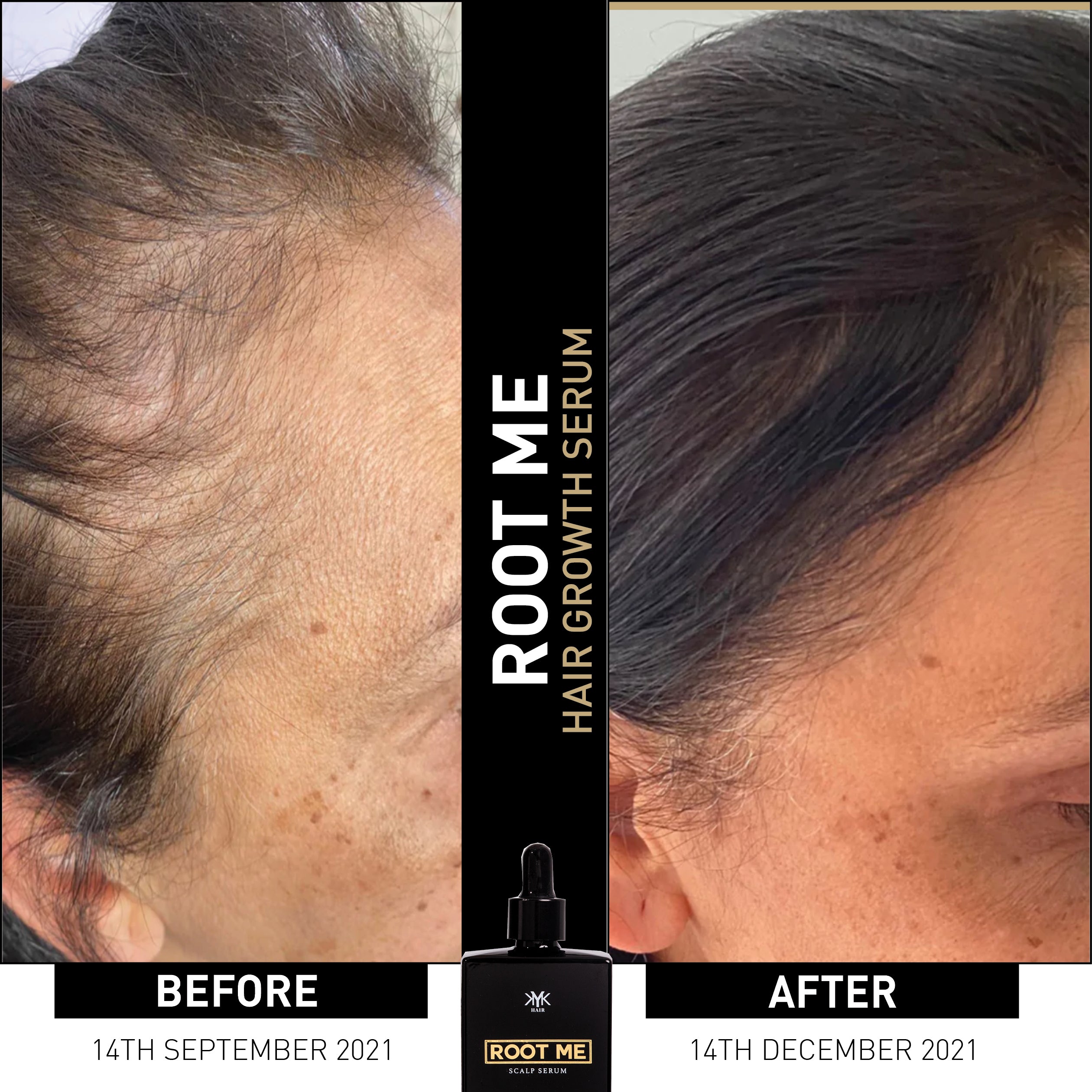 BEFORE AND AFTER - Treated with KYK ROOT ME
