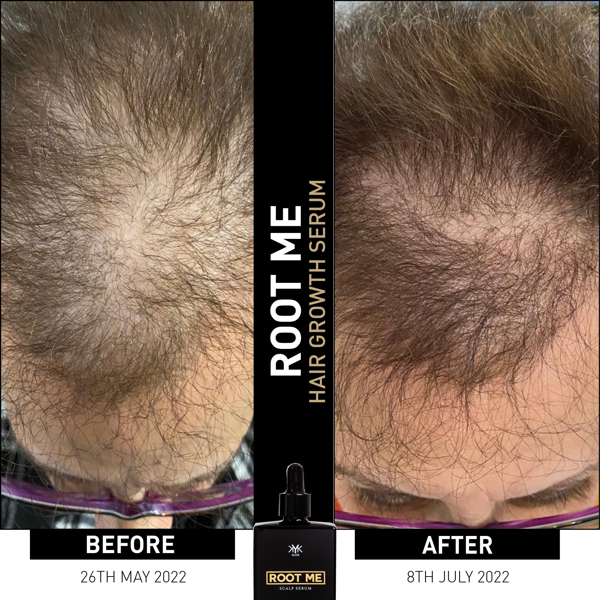 BEFORE AND AFTER - Treated with KYK ROOT ME