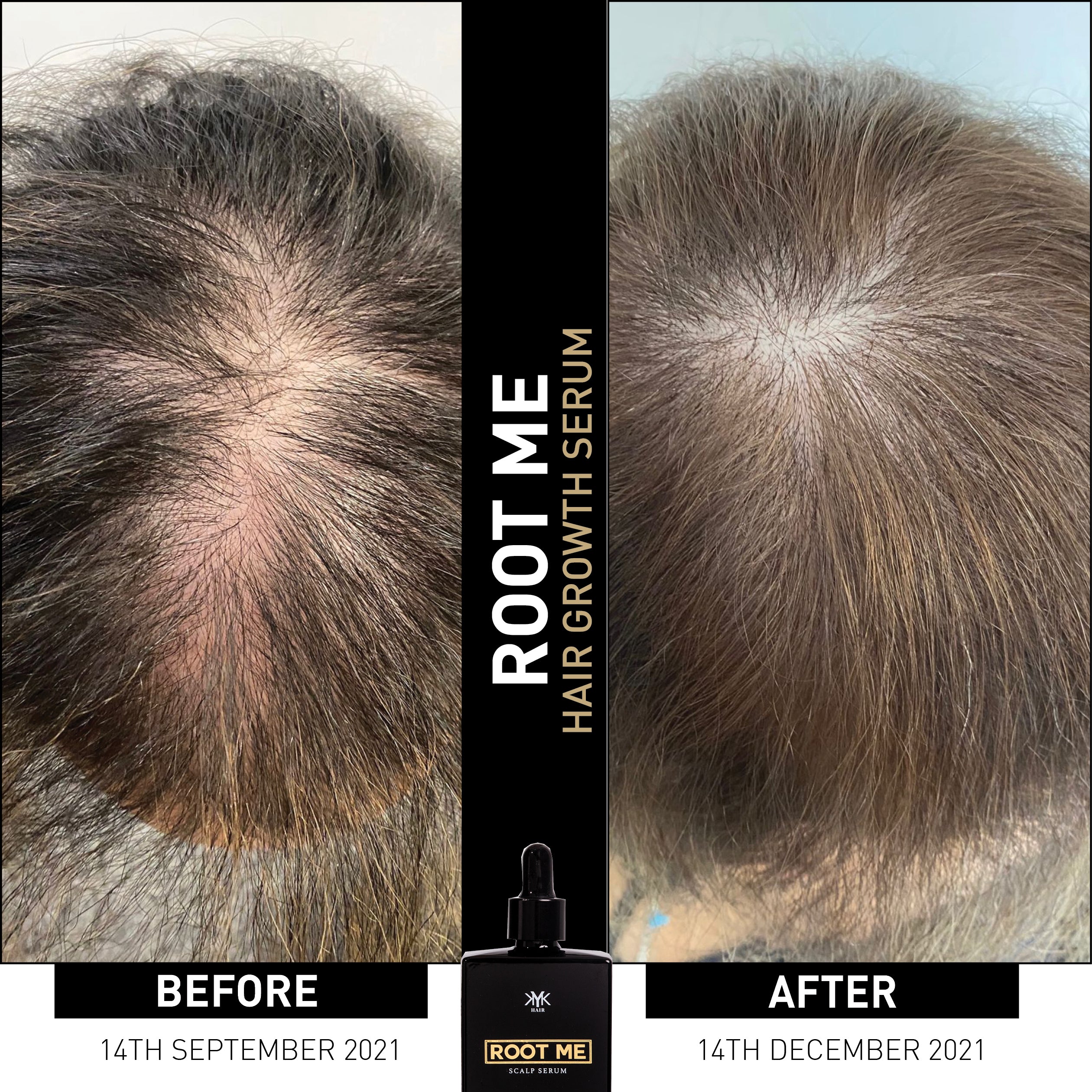 BEFORE AND AFTER - Treated with KYK ROOT ME