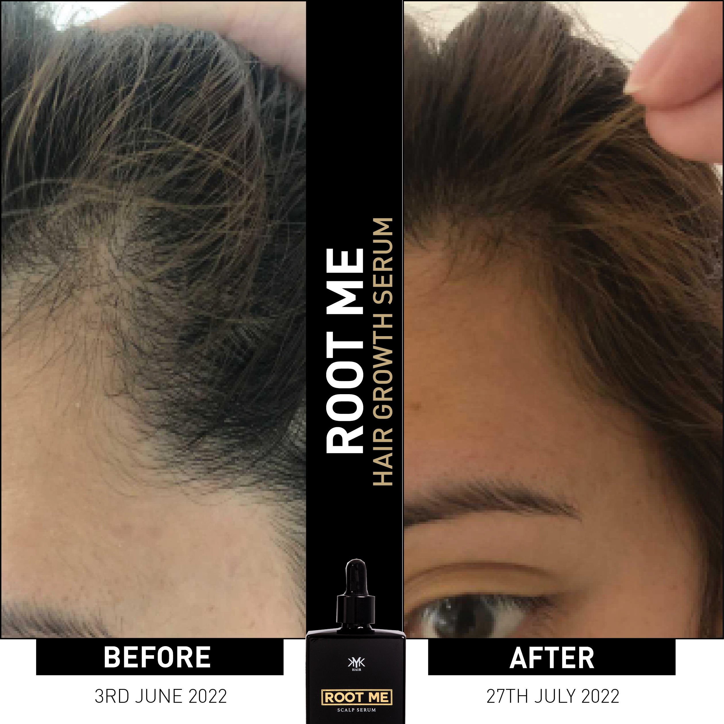 BEFORE AND AFTER - Treated with KYK ROOT ME