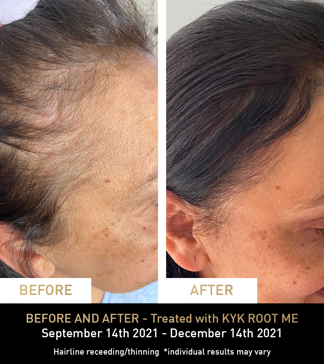 BEFORE AND AFTER - Treated with KYK ROOT ME