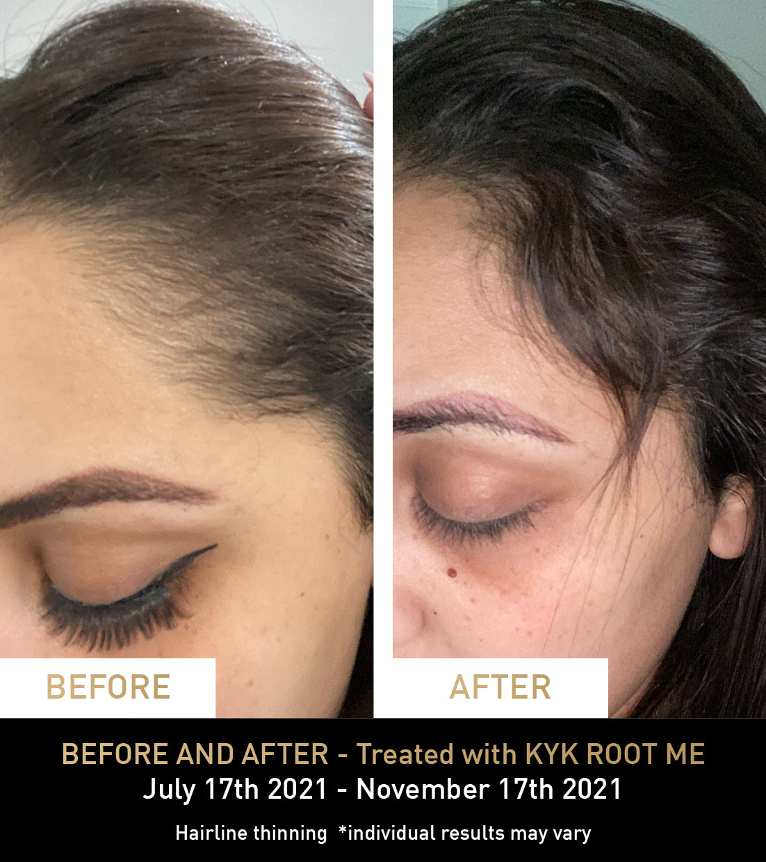 BEFORE AND AFTER - Treated with KYK ROOT ME