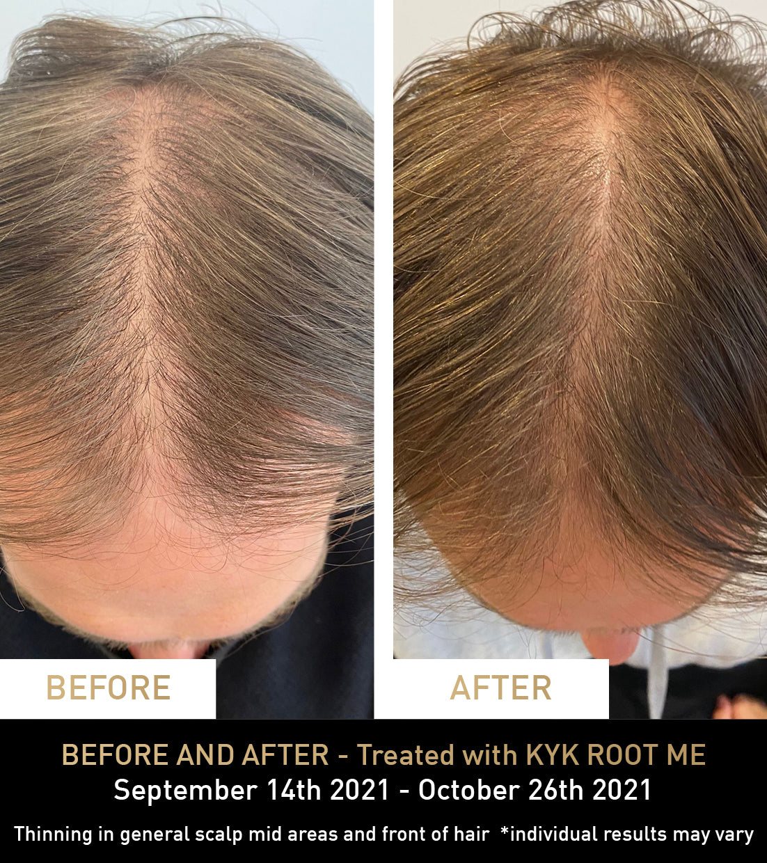 BEFORE AND AFTER - Treated with KYK ROOT ME