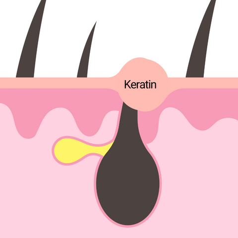 causes-of-keratosis-pilaris-explained-skin-condition-factors