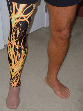 full leg laminated prosthesis