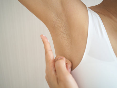 Cream for Underarm Rash