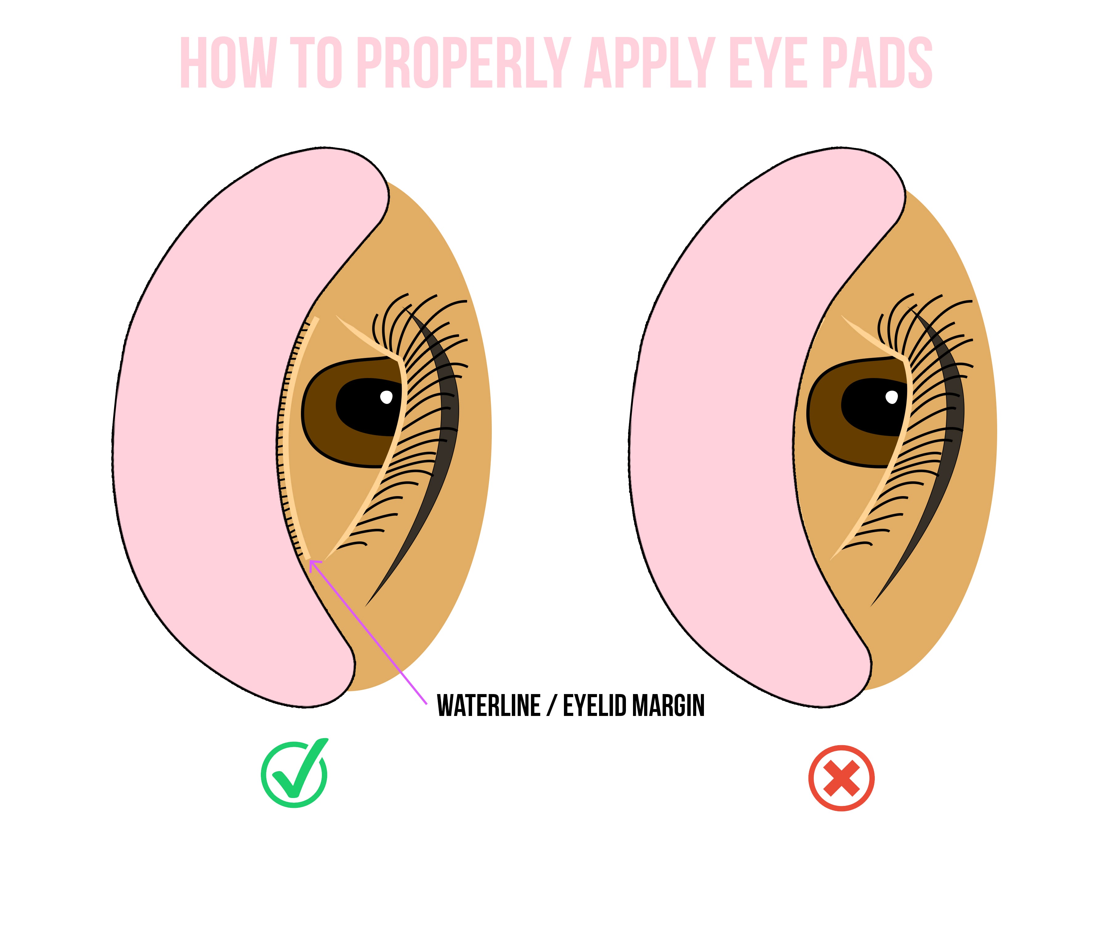 Correct vs Incorrect Under Eye Pad Application