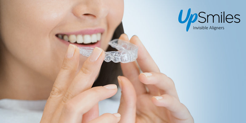 how aligners work