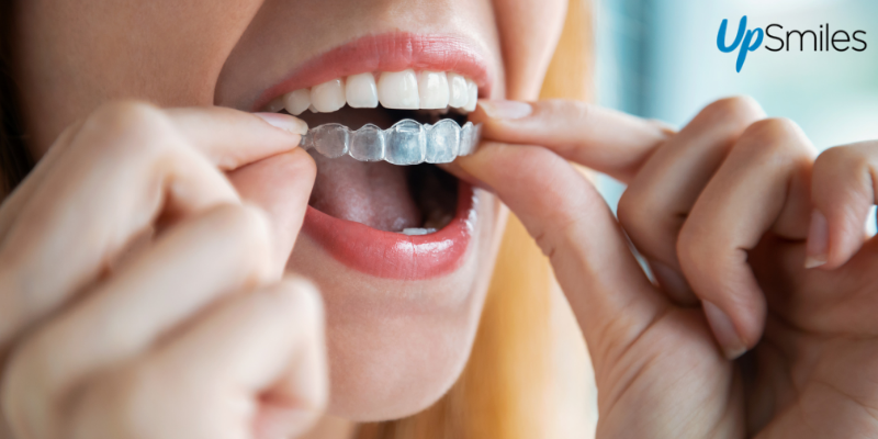 don'ts when you wear aligners