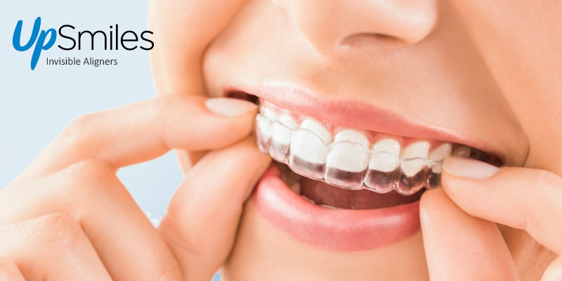 benefits of teeth aligners