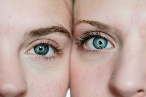 A close up shot of two girls with sensitive skin