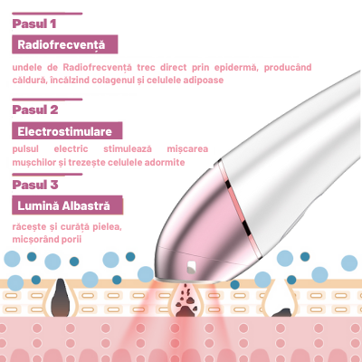 Dispozitiv Facial de Infrumusetare cu Radiofrecventa, Portabil