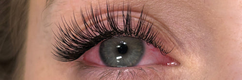 How to Recognise an Allergic Reaction to Eyelash Extensions