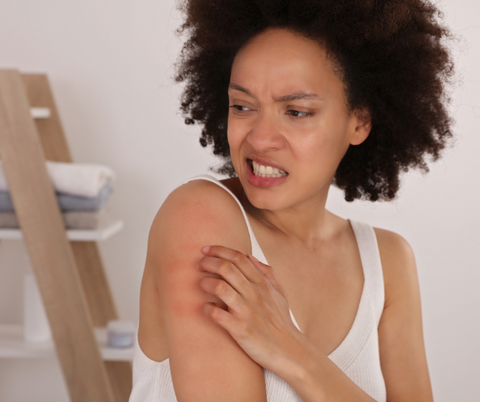 eczema dry skin 
