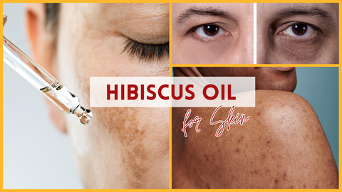 roselle_hibiscus_oil_skin_hyperpigmentation