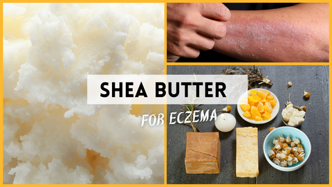 shea butter_eczema