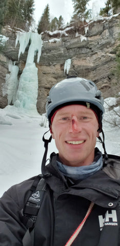 Ambassador Trevor with a cut on his nose, after his ice climb