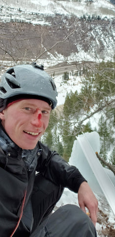 Ambassador Trevor with a cut on his nose, after his ice climb